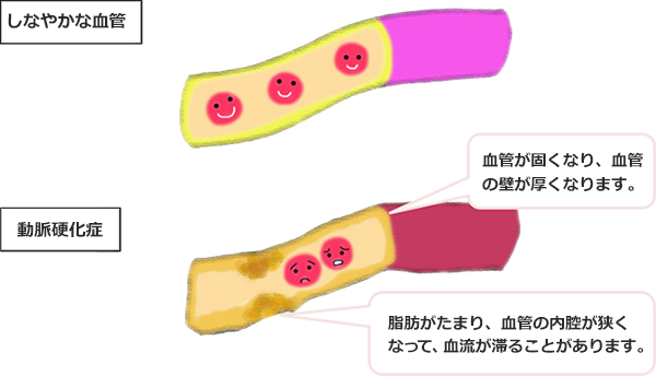 大血管症